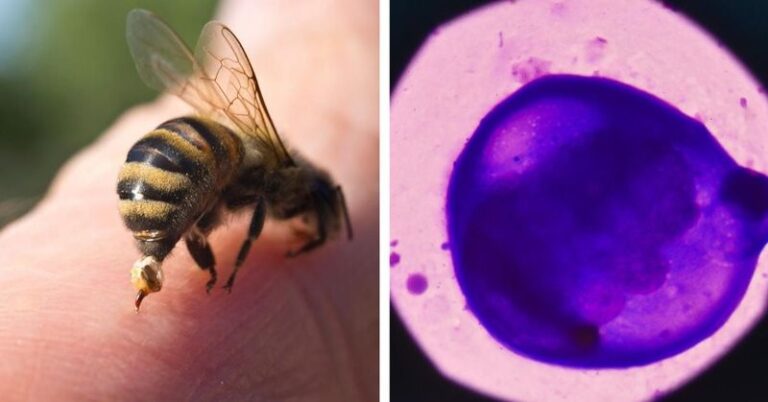 If Your Beehive Neighbors Have You Curious, Here’s The Precise Way Bee Venom Locks Onto Cancer Cells